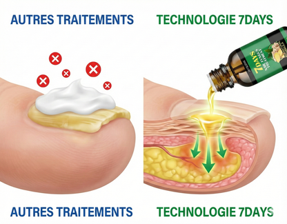 ¿Avergonzada de mostrar tus pies? Elimina el hongo de las uñas en solo 7 días﻿