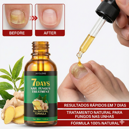 ¿Avergonzada de mostrar tus pies? Elimina el hongo de las uñas en solo 7 días﻿